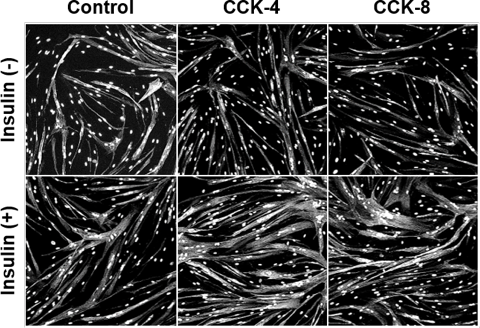 コレシストキニンとインスリンは筋管形成を促進する / Cholecystokinin with insulin induces myotube formation