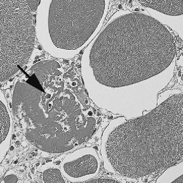 肉用鶏の筋組織における炎症 / Inflammation in broiler muscle tissue