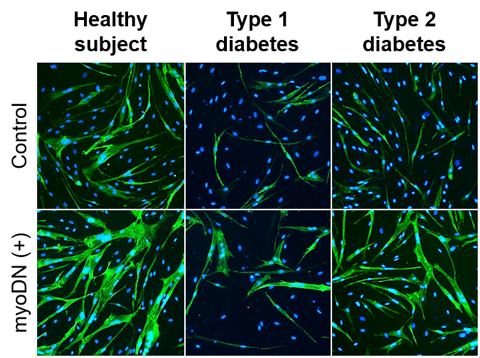 myoDN は糖尿病筋芽細胞の分化を改善する / myoDN recovers differentiation of diabetic myoblasts