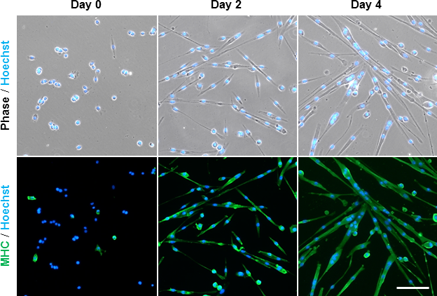 マウス筋芽細胞 / Murine myoblasts