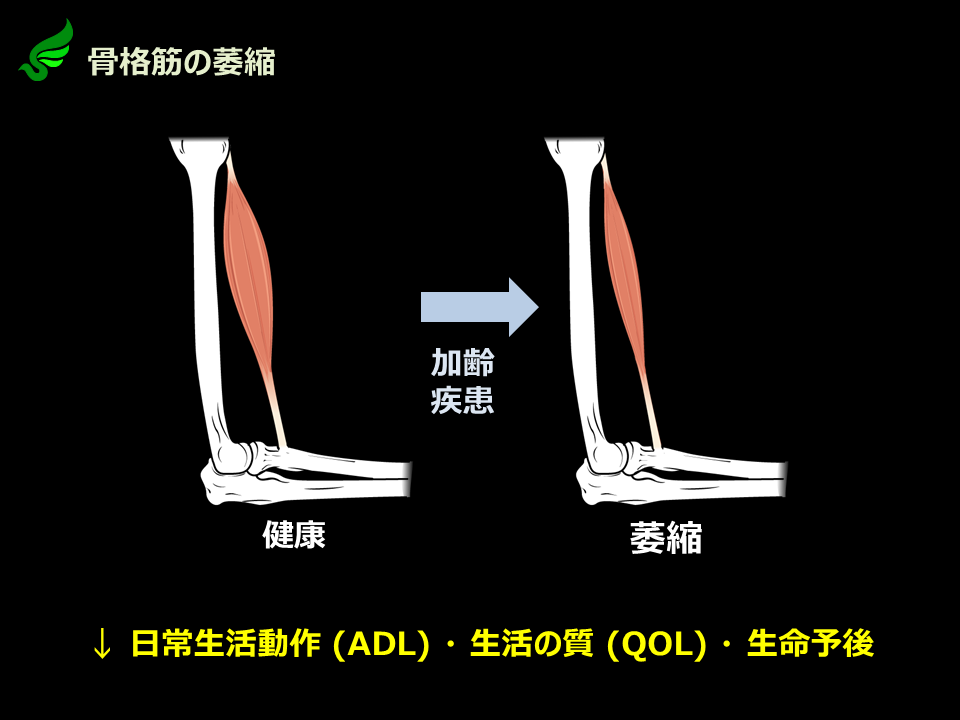骨格筋の萎縮